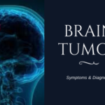 Brain Tumor