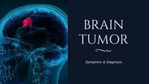 Brain Tumor