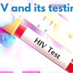 HIV