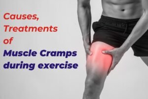 Causes and Treatment of Muscle Cramps during Exercise