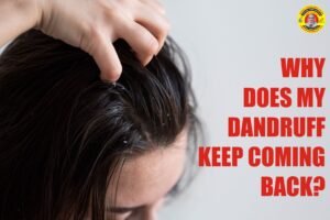 dandruff hair